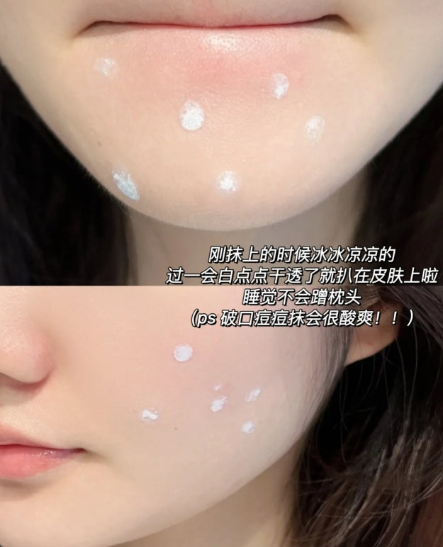 Tiktok/Douyin Hot BR:LAB Acne Repair Essence 10ml【Tiktok抖音爆款】蓓安亲研祛痘修护精华液