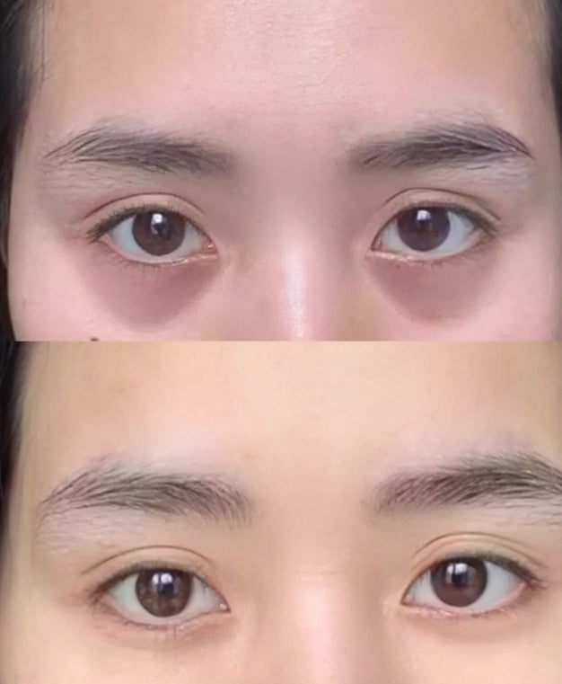 Tiktok/Douyin Hot Bai Yun Shan Anti-Wrinkle Eye Essence Oil 20ml【Tiktok抖音爆款】白云山眼部抗皱植萃精华油