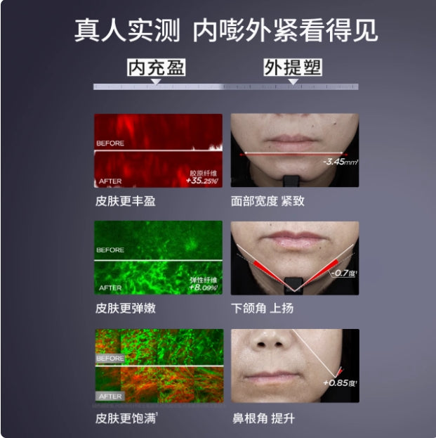 Biohyalux Firming & Plumping Essence Cream 50g 润百颜紧致充盈精华面霜