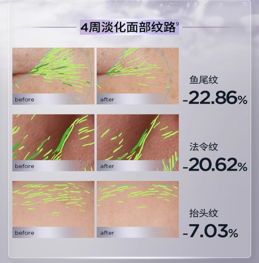 Biohyalux Timeless Rejuvenating Essence Mask 30g*5pcs 润百颜凝时焕颜精华面膜