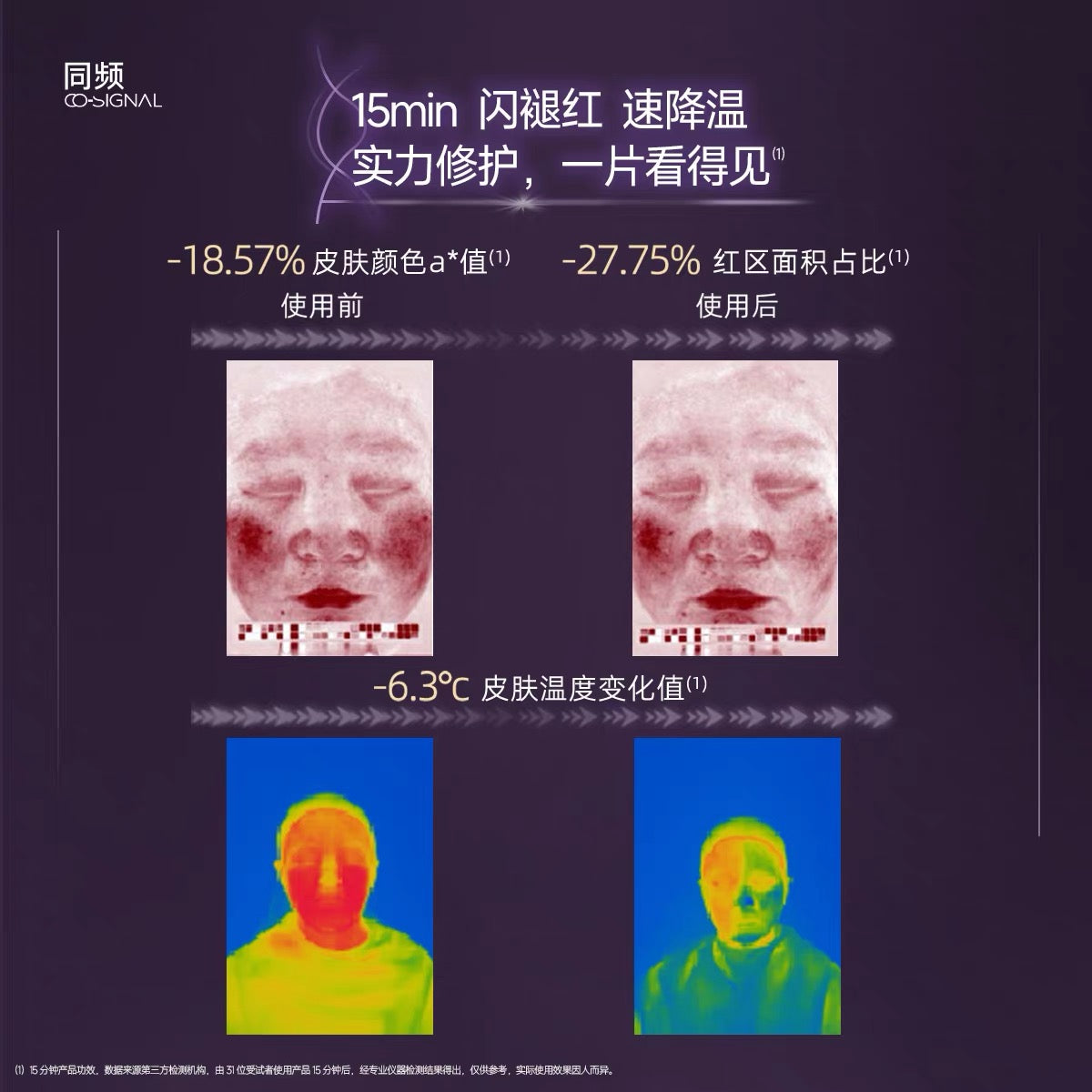 CO-SIGNAL Multi-Collagen Sensitive Repair Mask 25ml*5pcs/Box 同频多重胶原敏感修护面膜