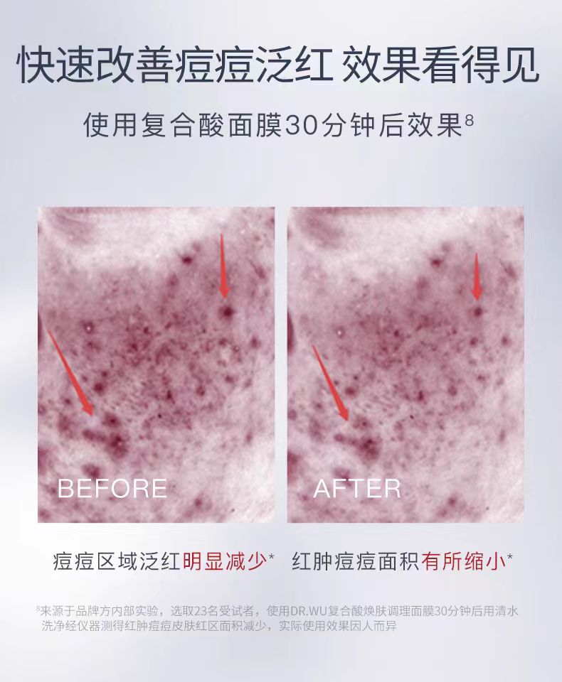 DR. WU Mandelik Multiple Acid Renewal Mask 50g 达尔肤复合酸焕肤调理面膜