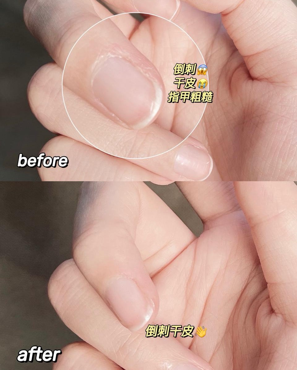 Dear Irean Hand Essence Oil 8ml 独特艾琳手部护理精华油