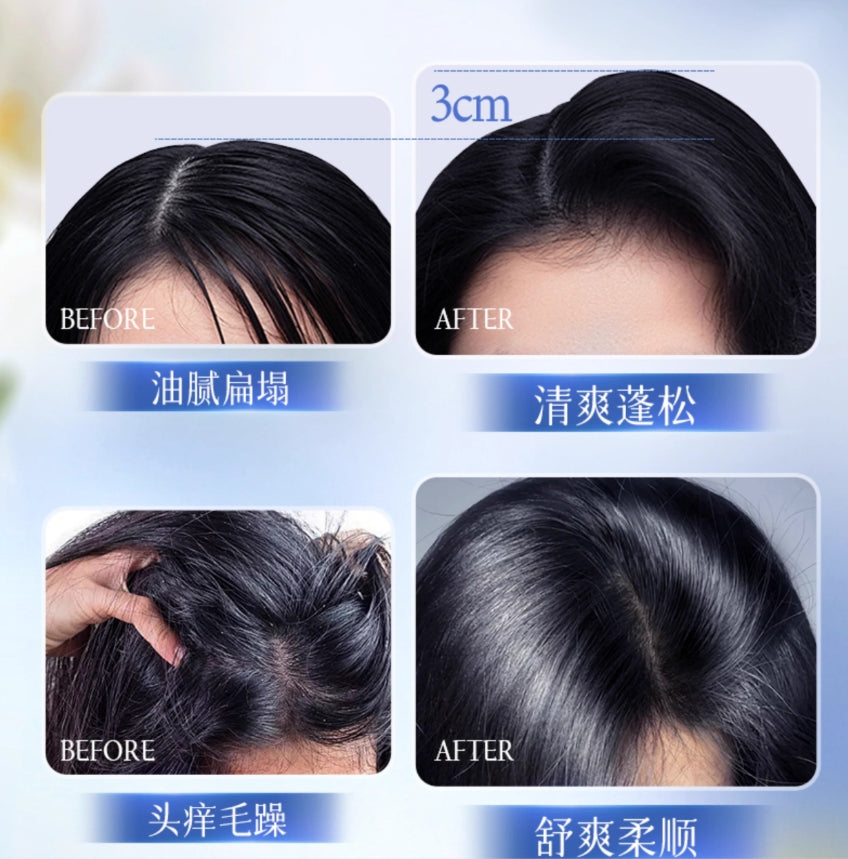 EHD Oil-Control Volumizing Dry Shampoo 100g EHD控油蓬松免洗洗发露