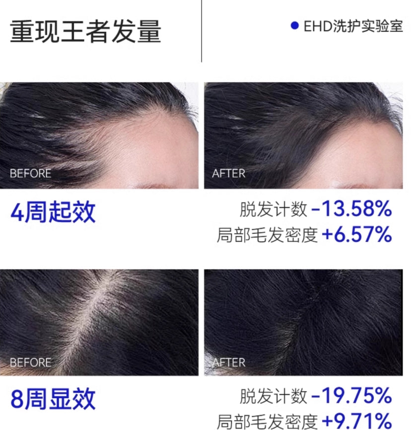 EHD Purifying Anti-Hair Loss Treatment Serum 2.5ml*16pcs EHD净澈防脱固发液
