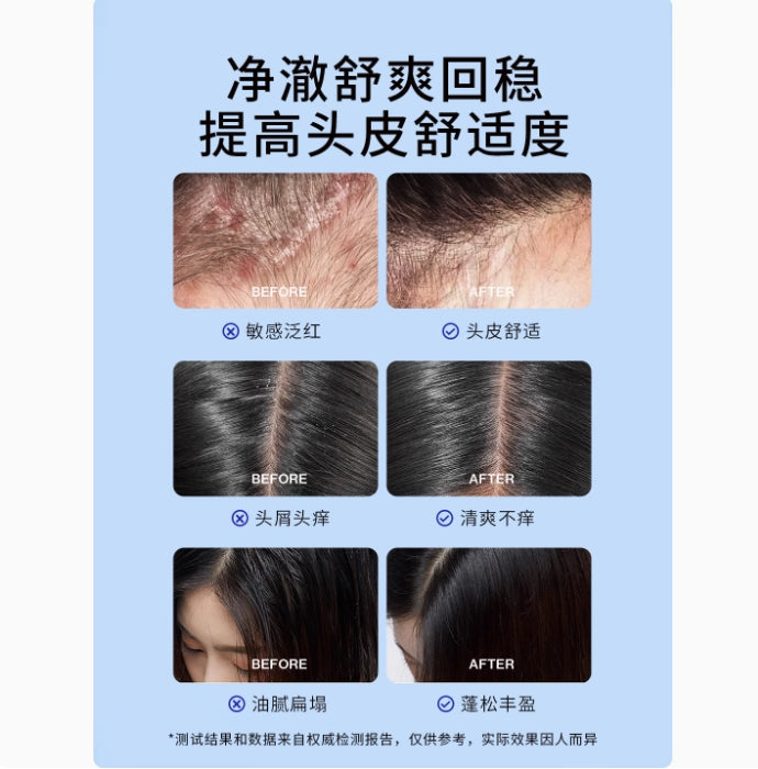 EHD Scalp Care Soothing Essence Ampoule Serum 6ml*14pcs EHD头皮护理舒缓精粹安瓶精华液