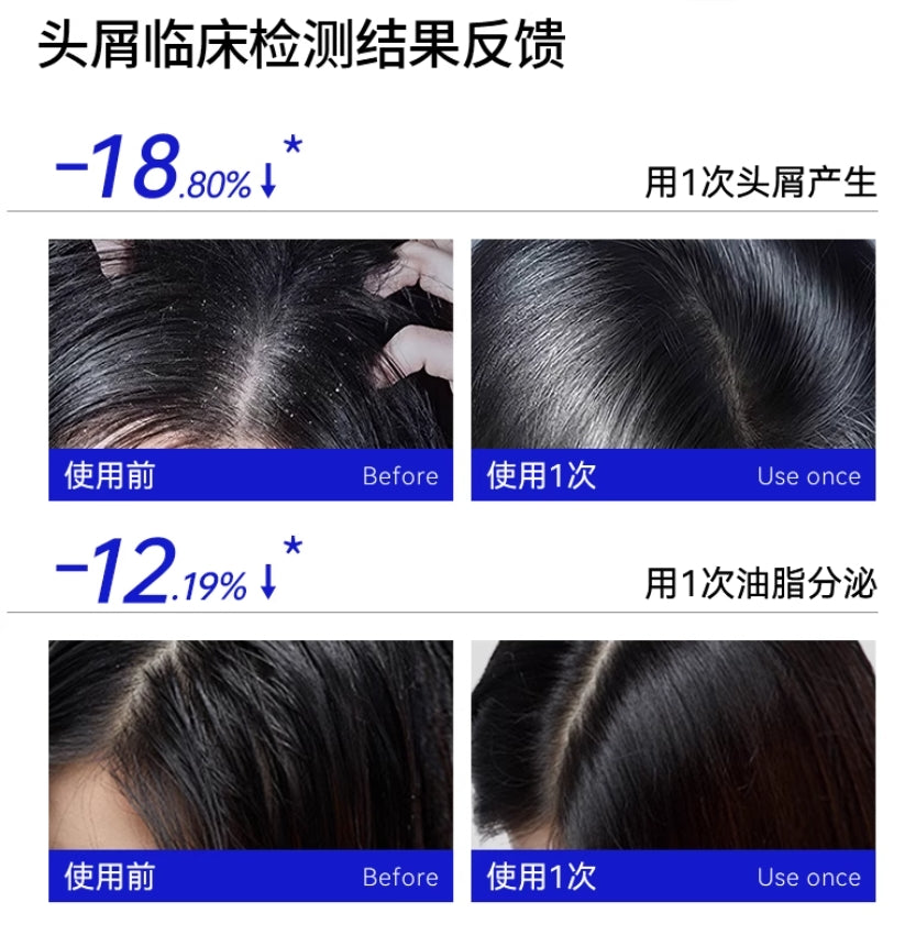 EHD Selenium Disulfide Oil-Control & Anti-Dandruff Shampoo 400ml EHD二硫化硒控油去屑洗发水