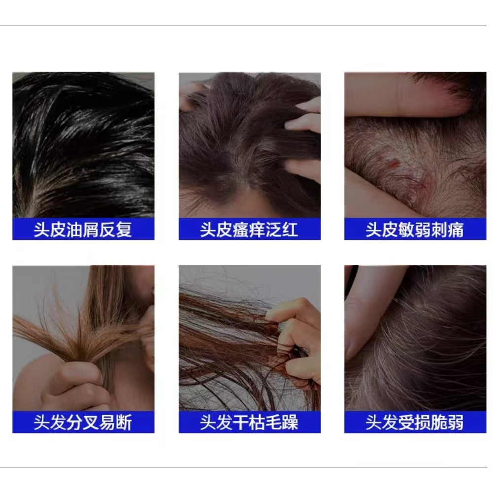 EHD Thirteen Plant Based Scalp Care Fluids 50ml*6pcs EHD十三重植萃头皮养护液