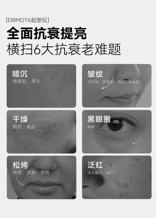 ERIMOTA Facial Ultra Sculpting Device ERIMOTA面部超塑仪