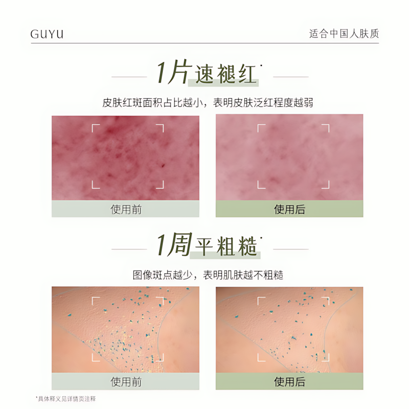 GUYU Centella Edelweiss Essence Mask (1.5ml+30ml)*5pcs 谷雨积雪绒花精华面膜