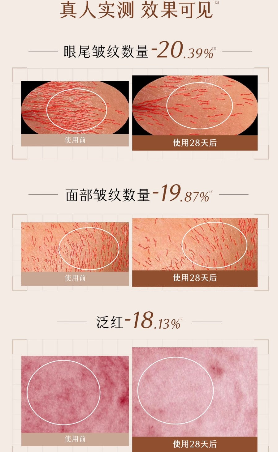 GUYU Elixir Firming Whitening Essence 1.5ml*5pcs/30pcs 谷雨御时极光淡纹祛斑精华液