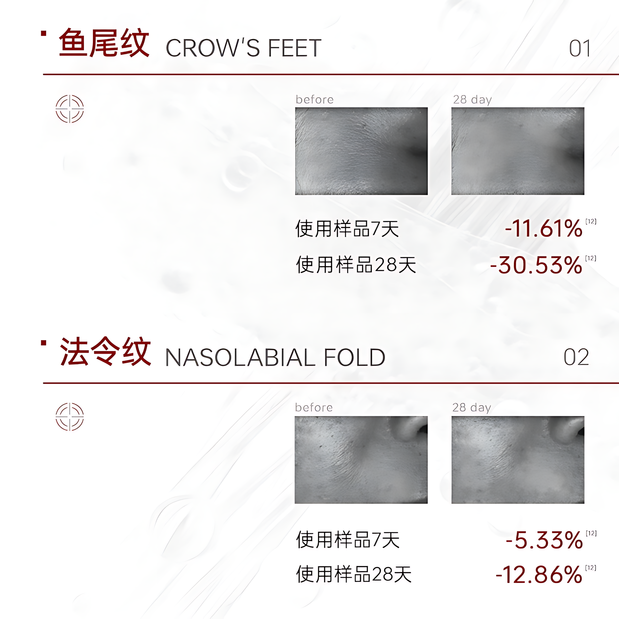 JOYRUQO Bifida Yeast Firming Light Line Essence 2.0 1.5ml*30pcs/box 娇润泉二裂酵母抗皱紧致淡纹次抛精华液2.0