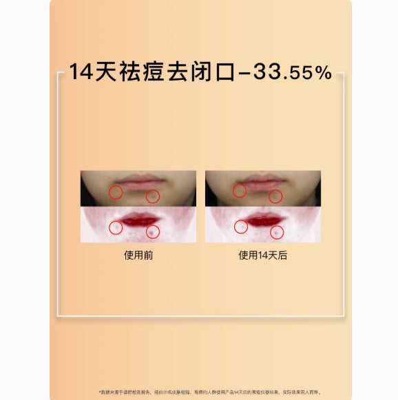 John Jeff Glycolic Acid Water 150ml John Jeff甘醇酸水