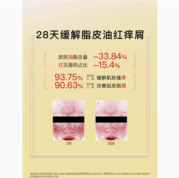 John Jeff Piroctone Ethanolamine Salt Sebaceous Skin Cleansing Mousse 150g John Jeff吡罗克酮乙醇胺盐脂皮洁面慕斯