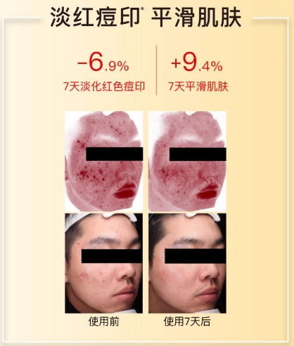 John Jeff Vitamin C Facial Mask (25g+1.32g)*10pcs John Jeff维C面贴膜