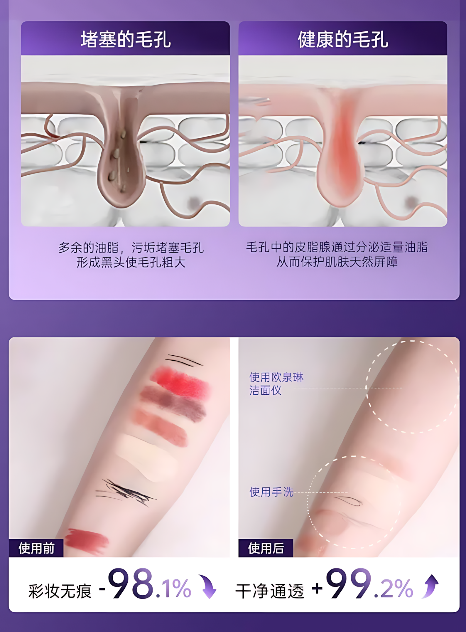 L'QUALYN Electric Silicone Facial Cleansing Device 欧泉琳电动硅胶洁面仪