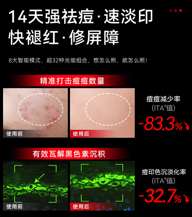 L'QUALYN LED Photon Skin Rejuvenation and Whitening Device 欧泉琳LED光子嫩肤焕白仪