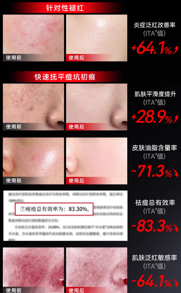 L'QUALYN LED Photon Skin Rejuvenation and Whitening Device 欧泉琳LED光子嫩肤焕白仪