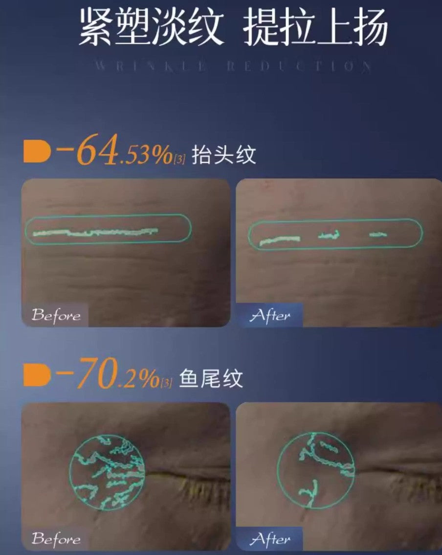 MEICHIC Hydrating Anti-Wrinkle Lifting Mask 30ml*5pcs/3boxes 美诗水光焕颜抗皱提拉面膜