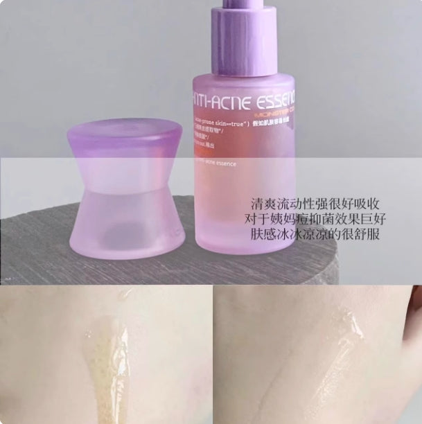 Tiktok/Douyin Hot MONSTER CODE Energy Acne Treatment Essence 30ml 【Tiktok抖音爆款】野兽代码蕴能祛痘精华液