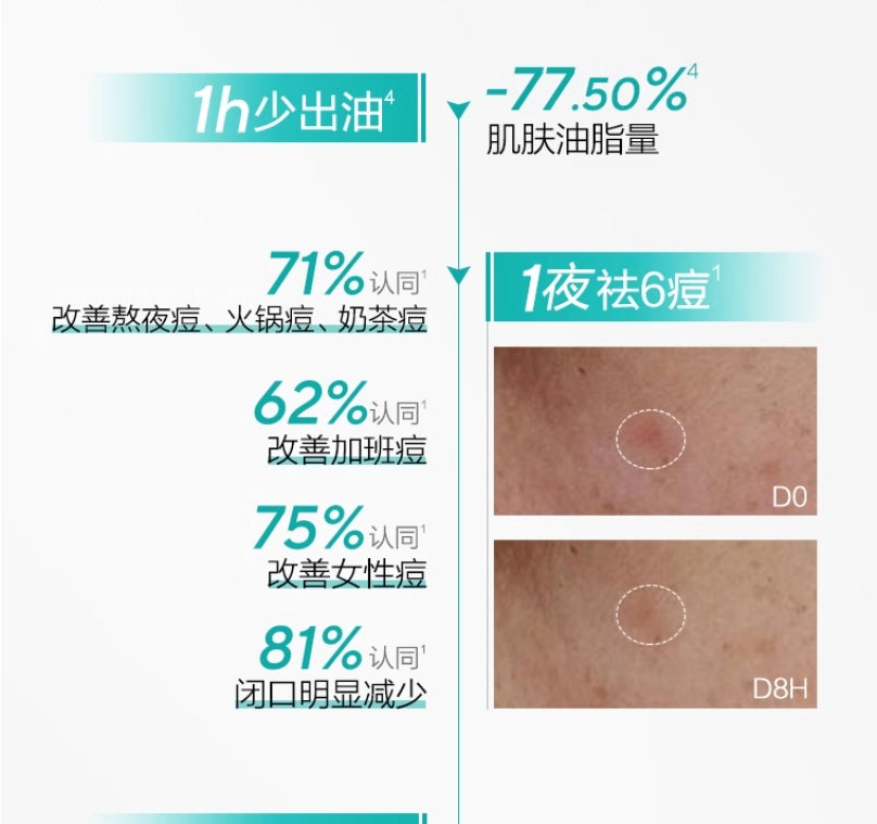 OSM Oil-Control Acne Treatment Single-Use Essence 20pcs/box 欧诗漫控油祛痘次抛精华液