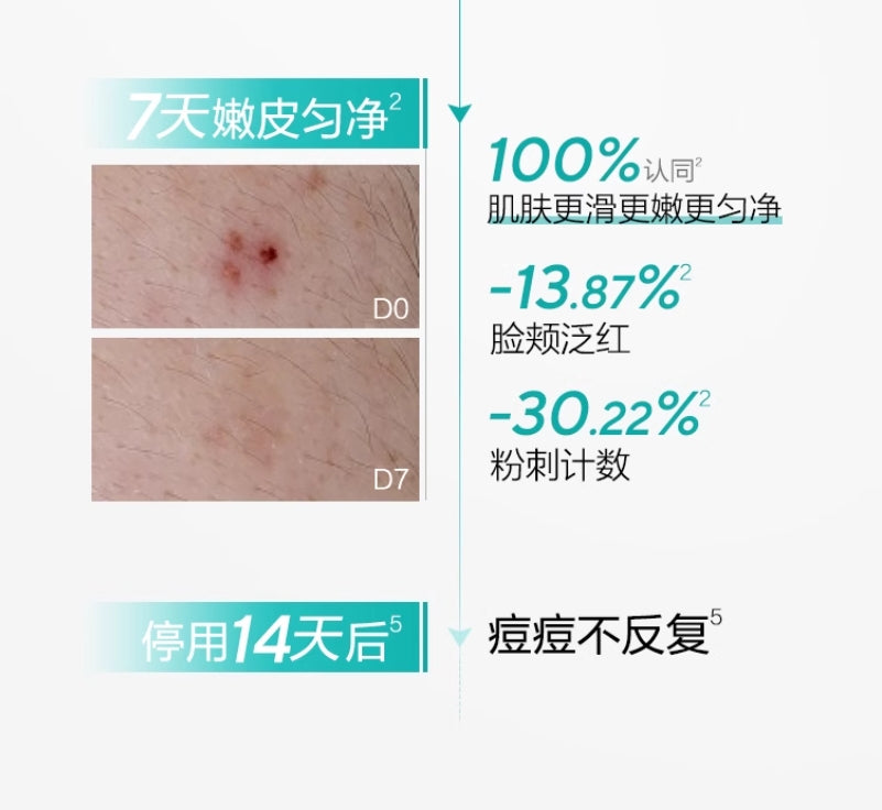 OSM Oil-Control Acne Treatment Single-Use Essence 20pcs/box 欧诗漫控油祛痘次抛精华液