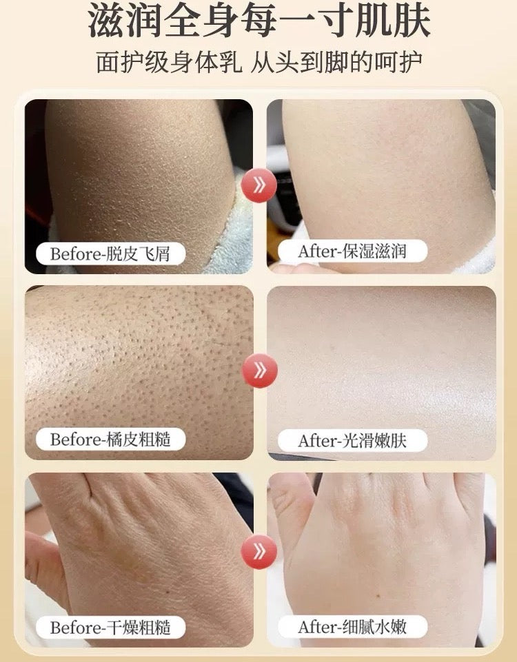 PECHOIN Anti-Itch Moisturizing Lotion 200g 百雀羚止痒润肤露