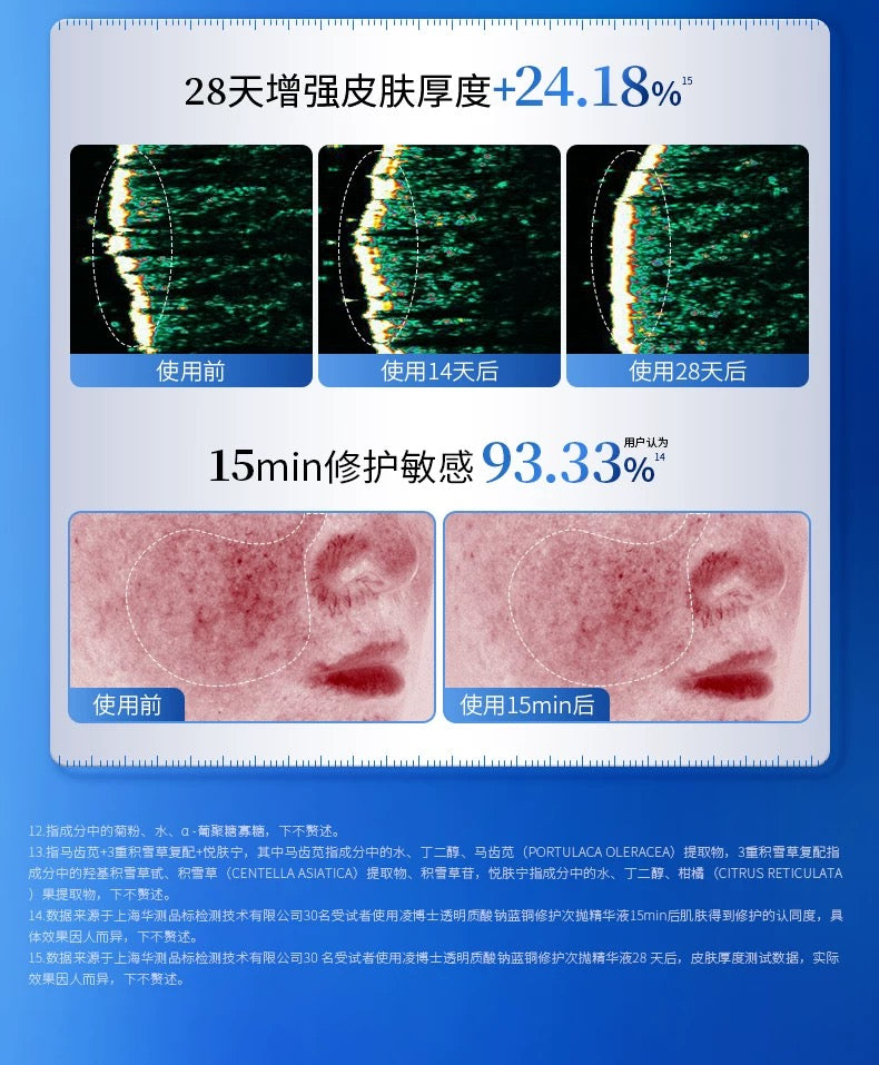 PROF.LING Sodium Hyaluronate Repair Single Use Essence 2.0 1.5ml*30pcs/box 凌博士透明质酸钠蓝铜修护次抛精华液2.0