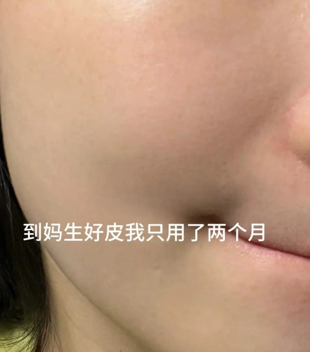 RNW Colloidal Sulfur Acne Powder Essence 10ml 如薇胶态硫祛痘粉精华液