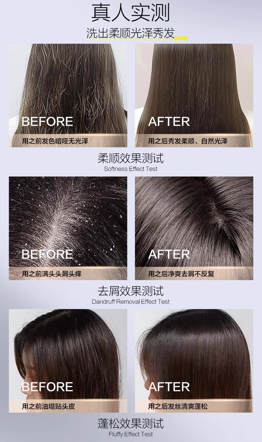 Tiktok/Douyin Hot Sanchine Fomes Officinalis Black Spruce Double Dandruff Removal Prevent Hair Breakage Shampoo 500ml【Tiktok抖音爆款】三精制药层孔菌黑云杉双仓去屑防断发洗发乳