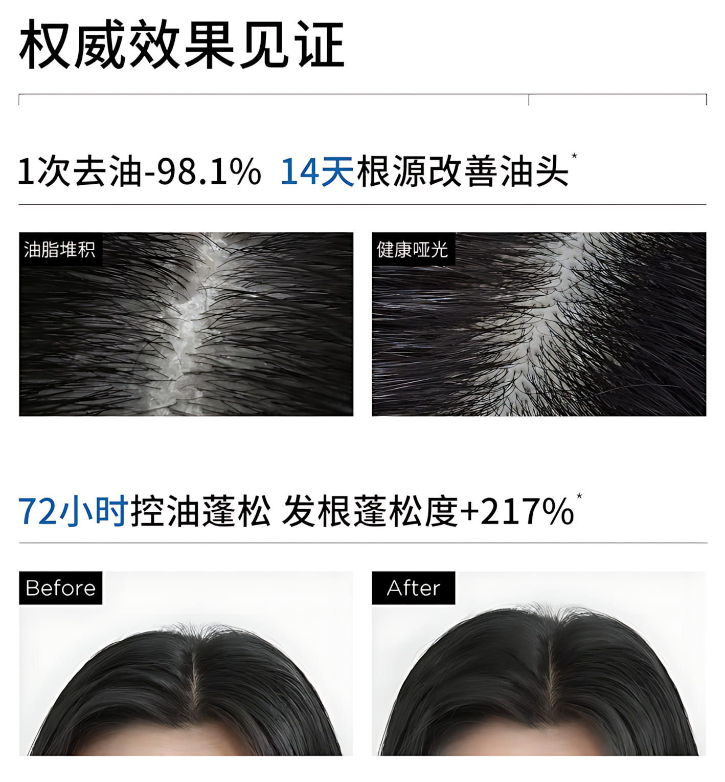 Tiktok/Douyin Hot 3odice Anti Hair Loss Dandruff Control Oil Control Shampoo 200ml/400ml【Tiktok抖音爆款】三蒂丝防脱去屑控油洗发水