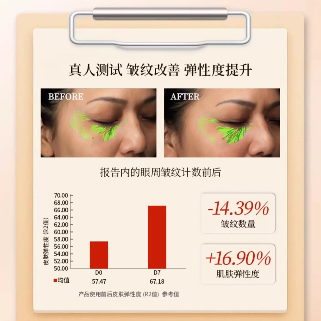 Tiktok/Douyin Hot Yuranm Eye Firming and Anti Wrinkle Essential Oil 20ml【Tiktok抖音爆款】瑜然美眼部紧致抗皱精油
