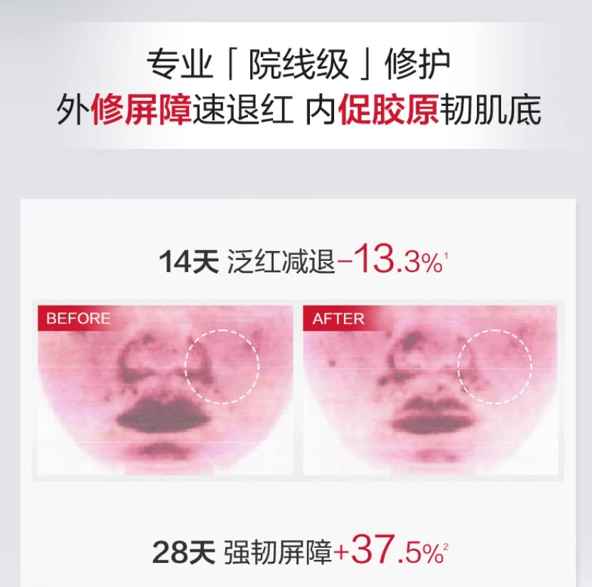 Winona Barrier Repair Serum 1.5ml*30pcs 薇诺娜屏障修护精华液