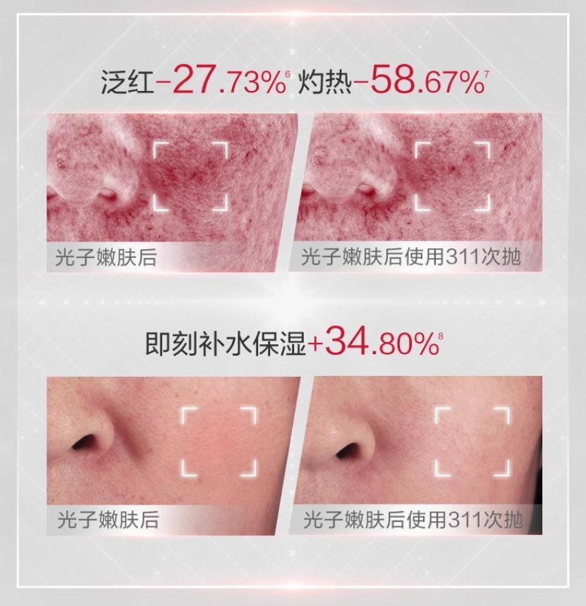 Winona Barrier Repair Serum 1.5ml*30pcs 薇诺娜屏障修护精华液