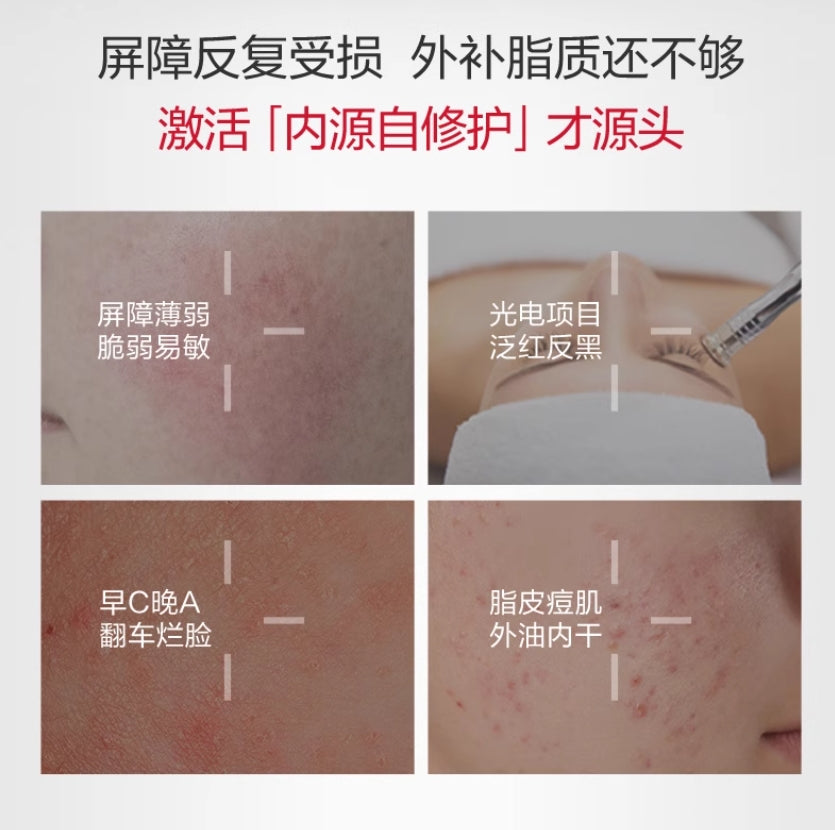 Winona Barrier Repair Serum 1.5ml*30pcs 薇诺娜屏障修护精华液