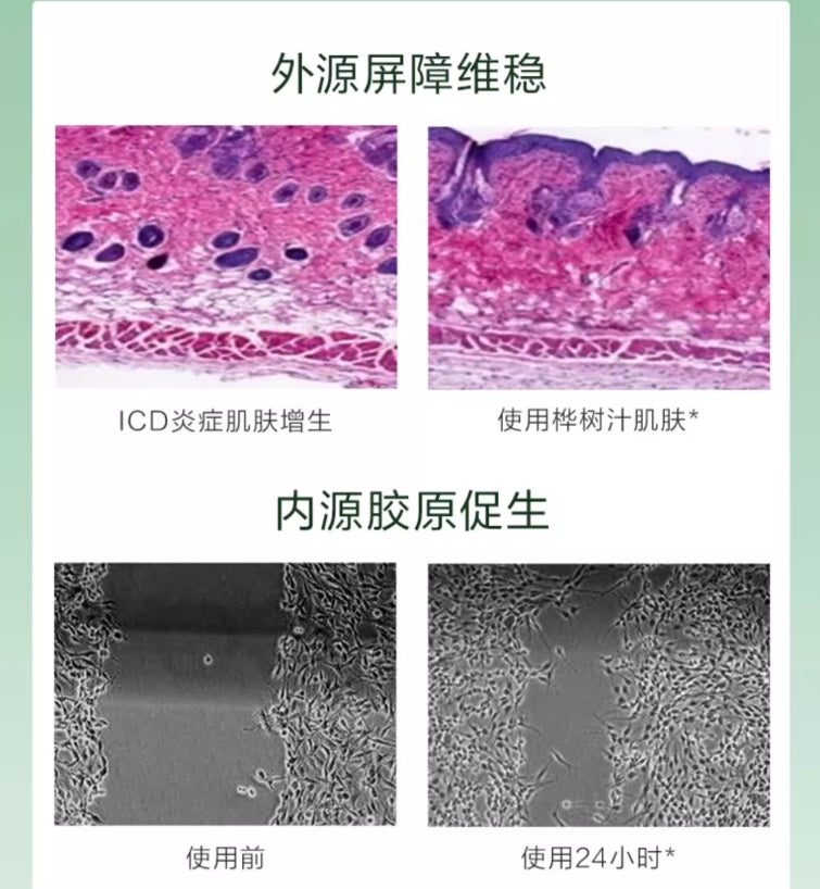 Tiktok/Douyin Hot YOSEIDO Birch Juice Hydrating & Moisturizing Mask 24ml*5pcs【Tiktok抖音爆款】养生堂桦树汁补水保湿面膜