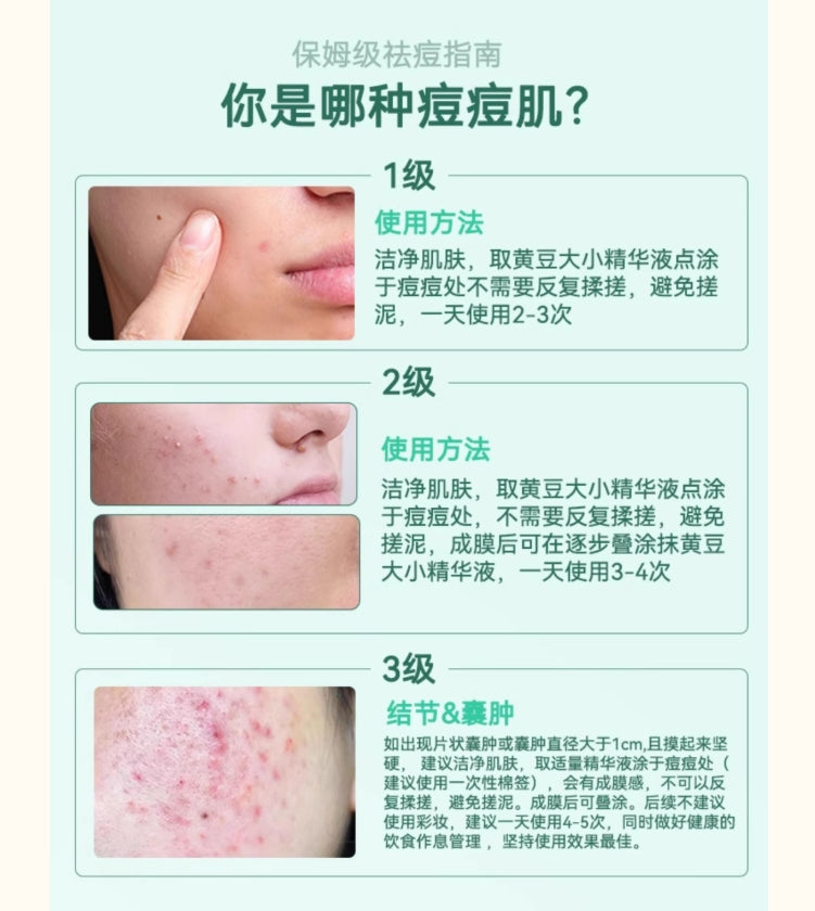 Tiktok/Douyin Hot Yin Shi Gentle Acne Treatment Serum 15ml【Tiktok抖音爆款】 因士柔酸祛痘精华液